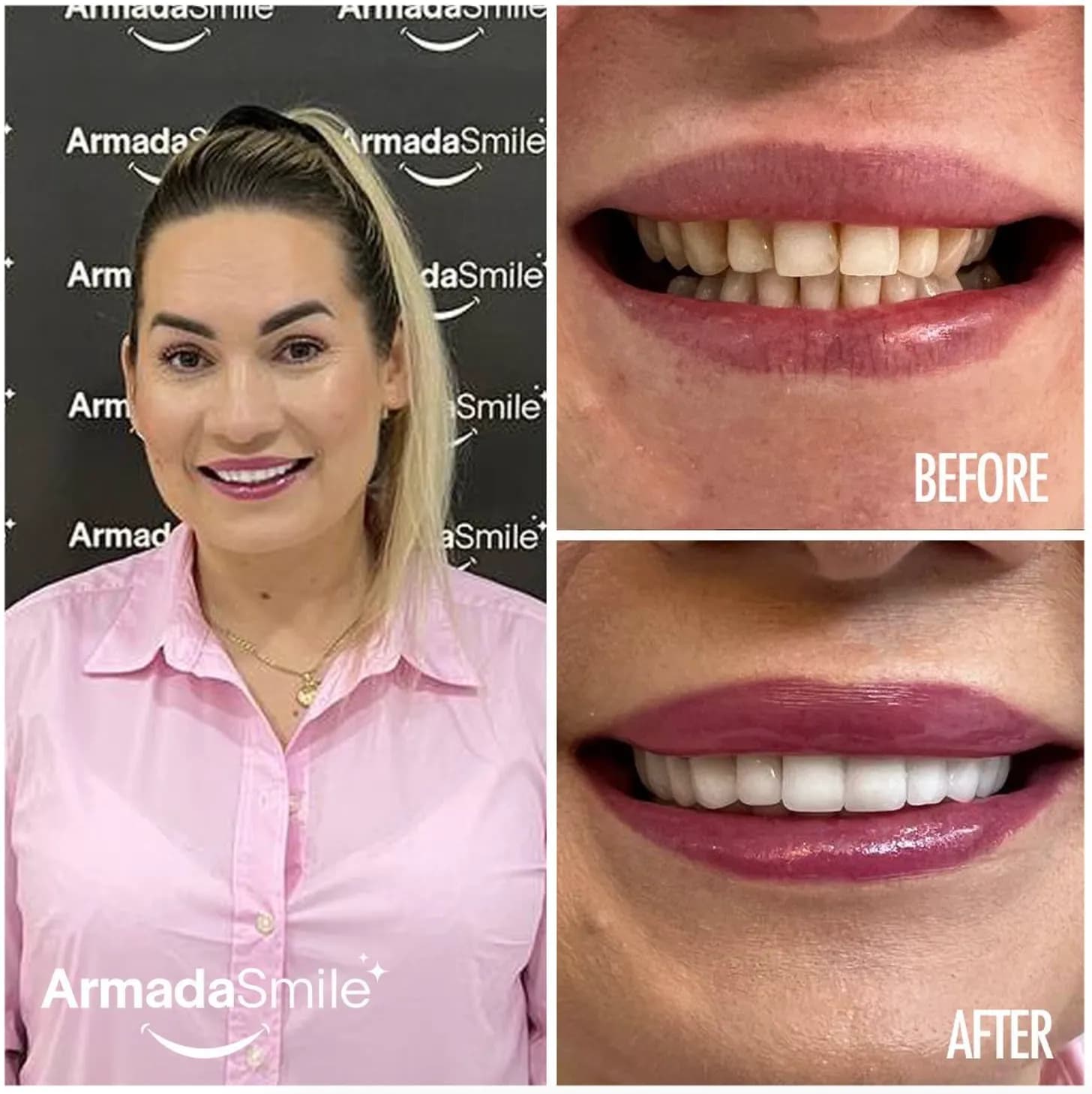 Before & after dental transformation 5