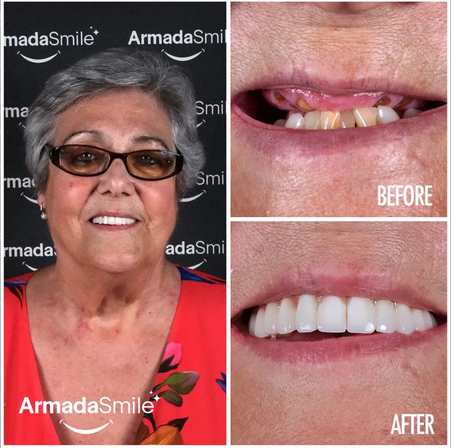 Real transformations from real patients.
